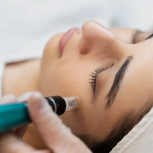 Hydro Facial Glow Treatment