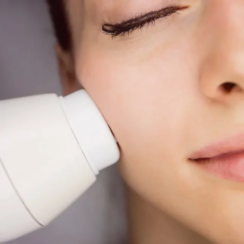 Radio Frequency (RF) Facial Treatment