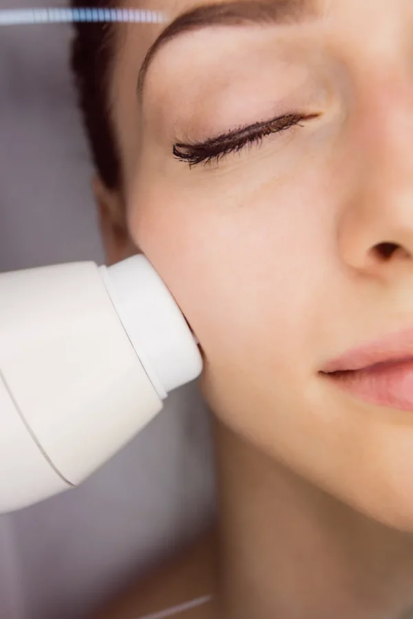 Radio Frequency (RF) Facial Treatment Radio Frequency (RF) Facial Treatment